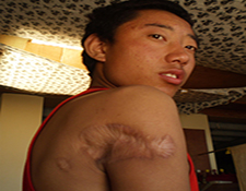 Dorjee Rinchen, 18 Survivor